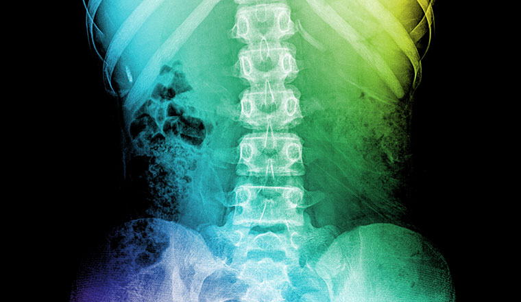 Future-Physio-Spinal